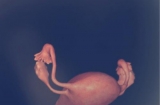 胎儿在肚子里什么样？十张图带你了解孕育全过程，每个人都该知道