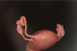 怀胎十月，各阶段胎儿发育组图，原来肚子里的宝宝是这样